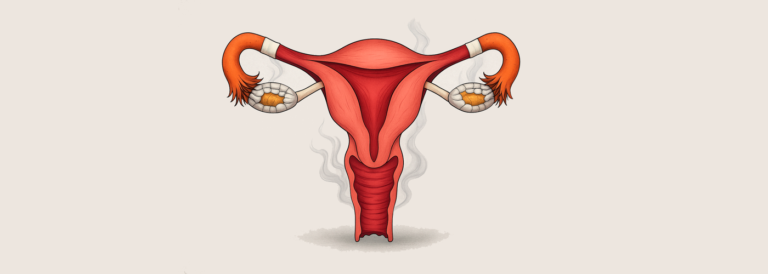 Ilustración del aparato reproductor femenino con humo saliendo del útero, símbolo del impacto negativo del tabaco en la fertilidad femenina.