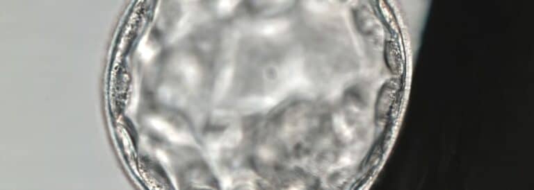 Imagen microscópica de un blastocisto en etapa avanzada, utilizado en tratamientos de fertilización asistida.